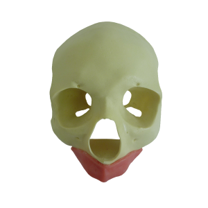 CRÂNIO FRONTAL All-on-4® STANDARD COM GENGIVA - cód. 9012G