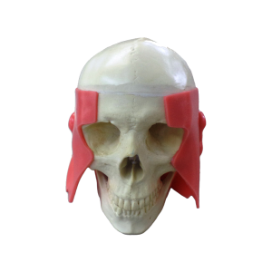 CRÂNIO PARA TREINAMENTO DE TÉCNICA DE ATM - cód. 10758