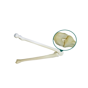 JOELHO COM CANAL MEDULAR ESPONJOSO E SIMULAÇÃO DE LIGAMENTOS - ESQUERDO - cód. 1010 L