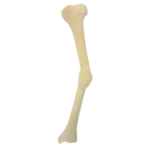 TÍBIA COM DEFORMIDADE MEDIAL E MÁ CALCIFICAÇÃO - ESQUERDA - cód. 2026 DMMC